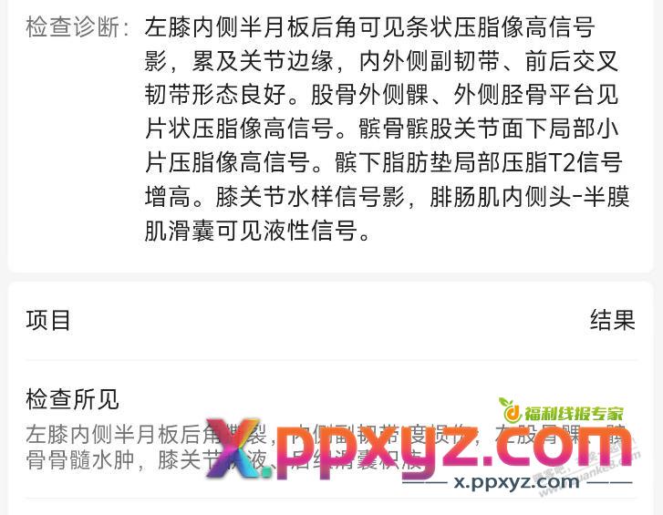 半月板撕裂，严重吗？ - PPXYZ线报