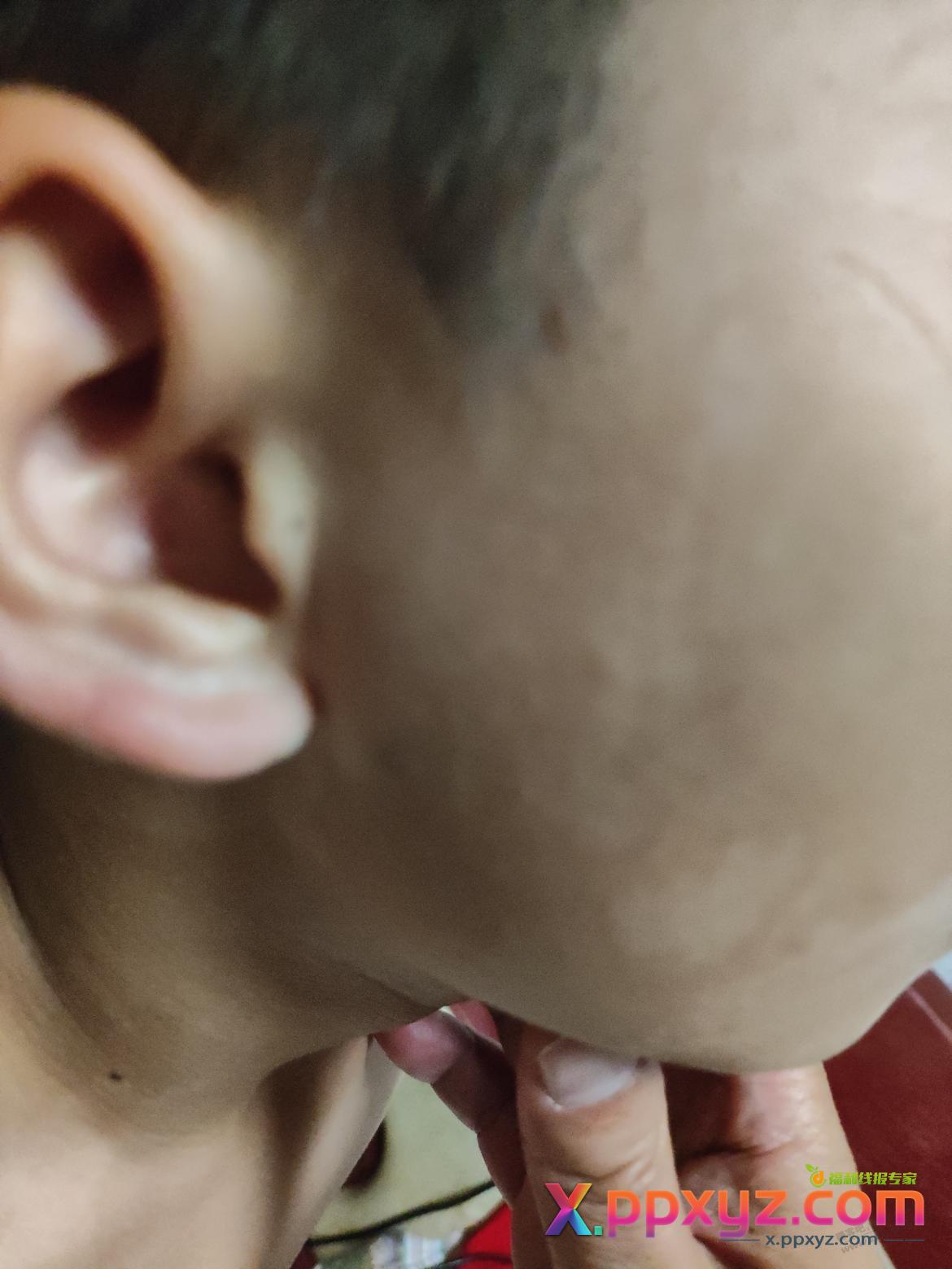 求助彦祖吧友，小孩脸上和脖子有黑色斑 - PPXYZ线报